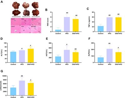 High-fat diet combined with dextran sulfate sodium failed to induce a more serious NASH phenotype than high-fat diet alone